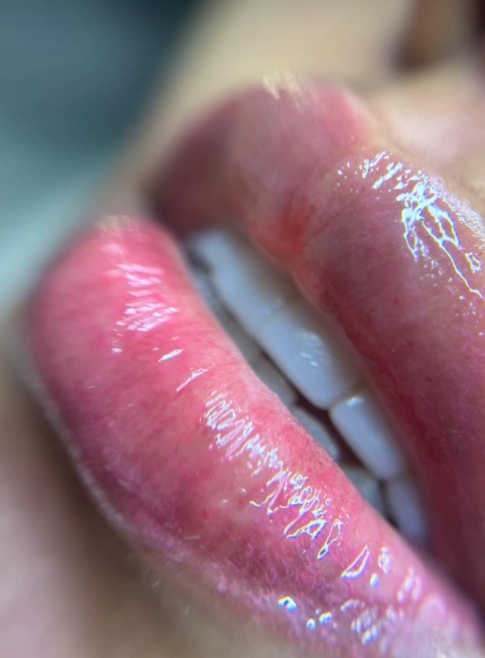 Vitaminas para Labios Angie Baron